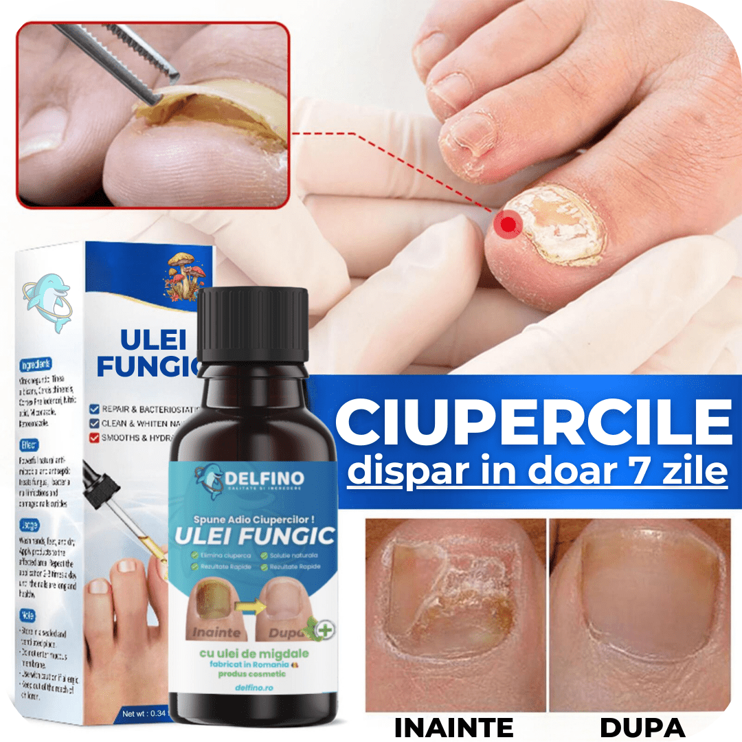 Ulei fungic pentru ciuperca fungica - Delfino®️